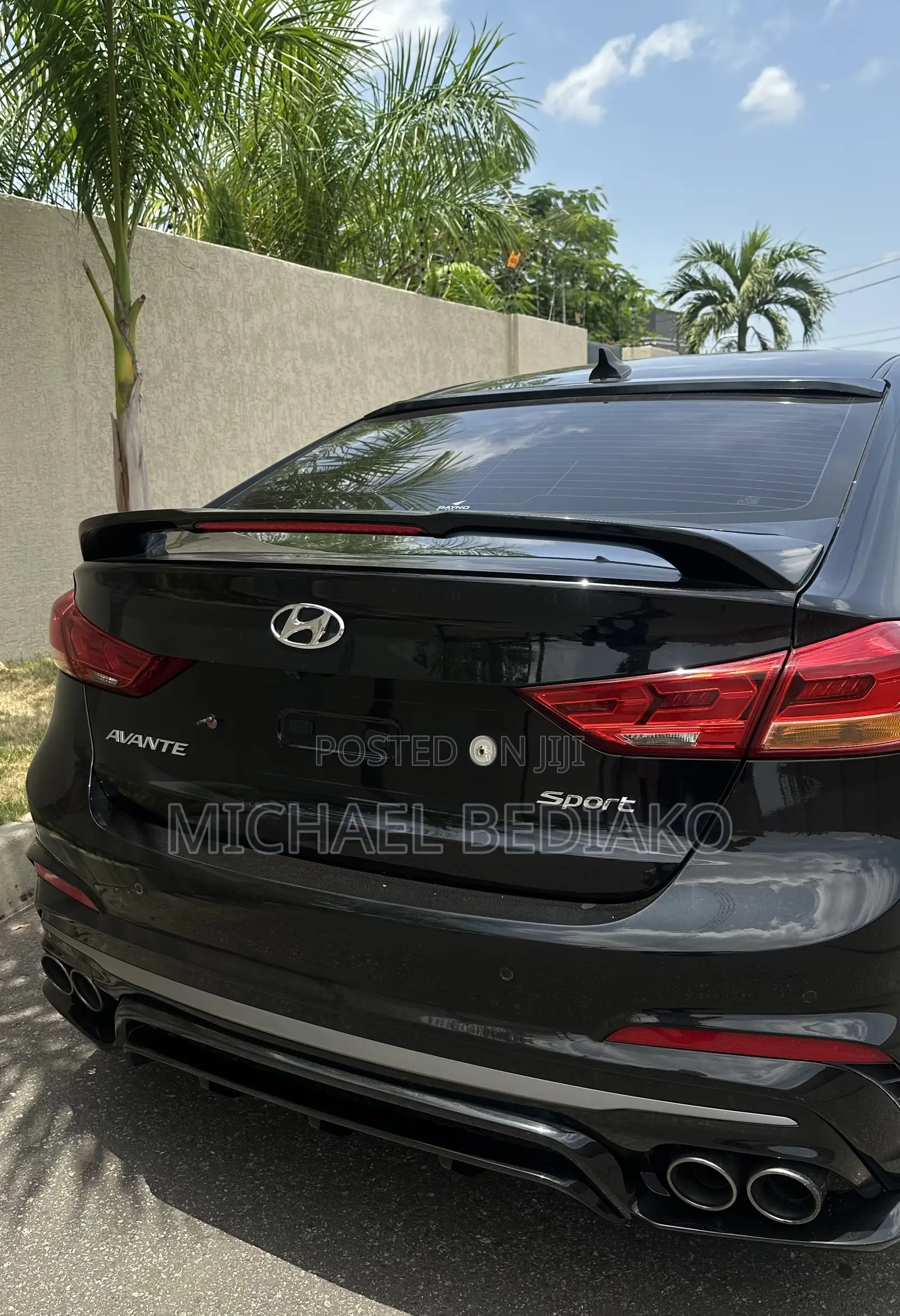 Hyundai Avante 2018 Black