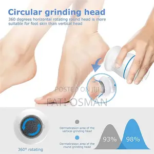 Callus Remover
