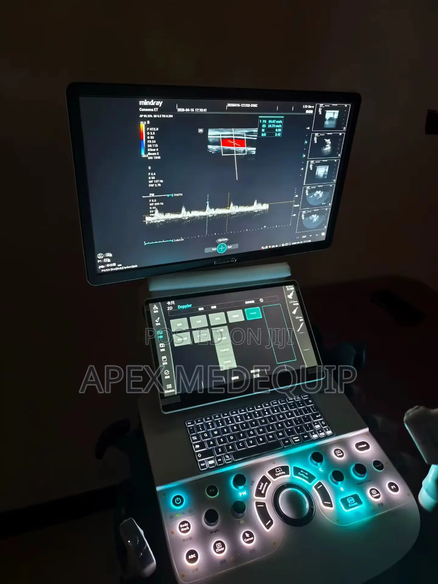 Mindray Consona Et 4d Color Doppler Ultrasound Machine + 3 Probes