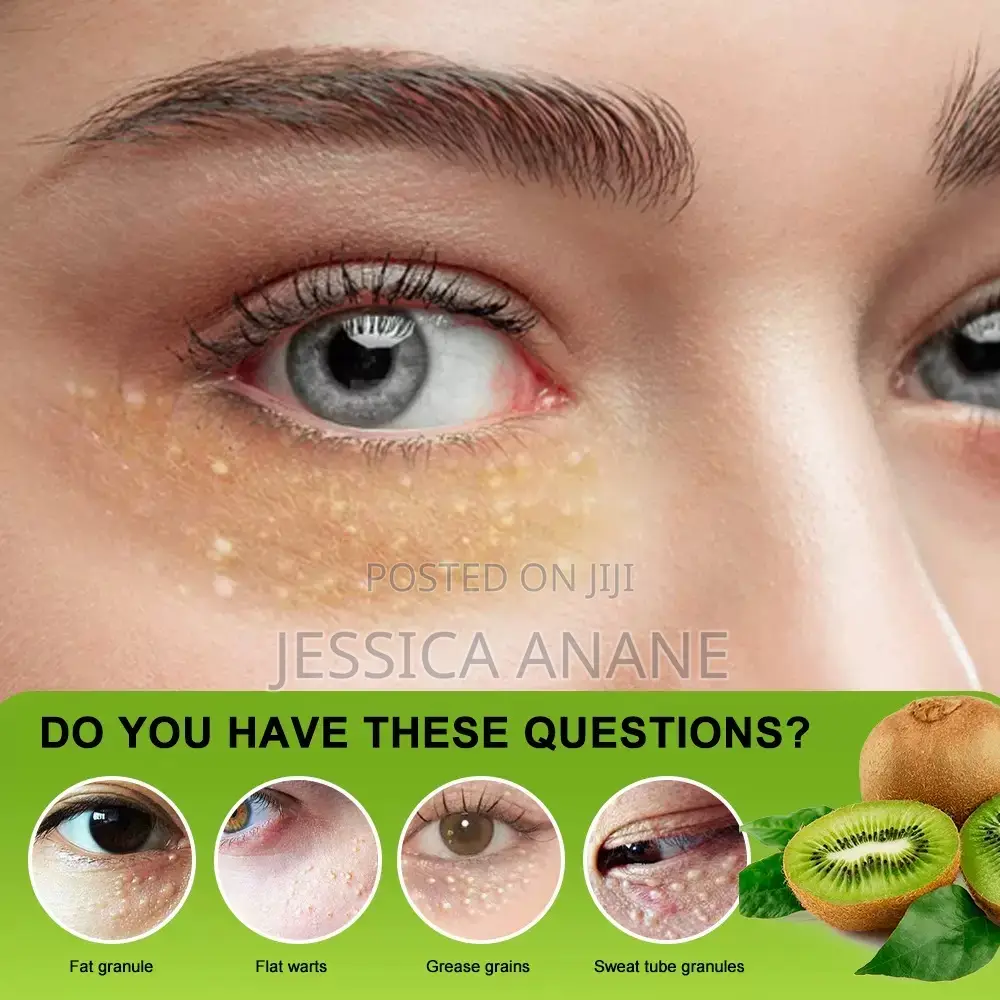 Sumifun Vitamin E Eye Care