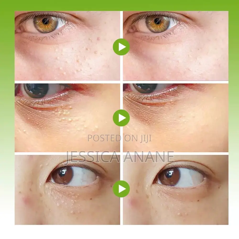 Sumifun Vitamin E Eye Care