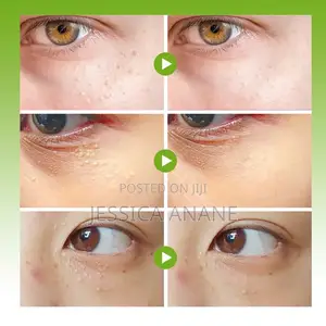 Sumifun Vitamin E Eye Care