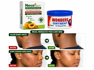 Nevaderm Exfoliating Soap + Wonders Ointment Clear Skin Combo