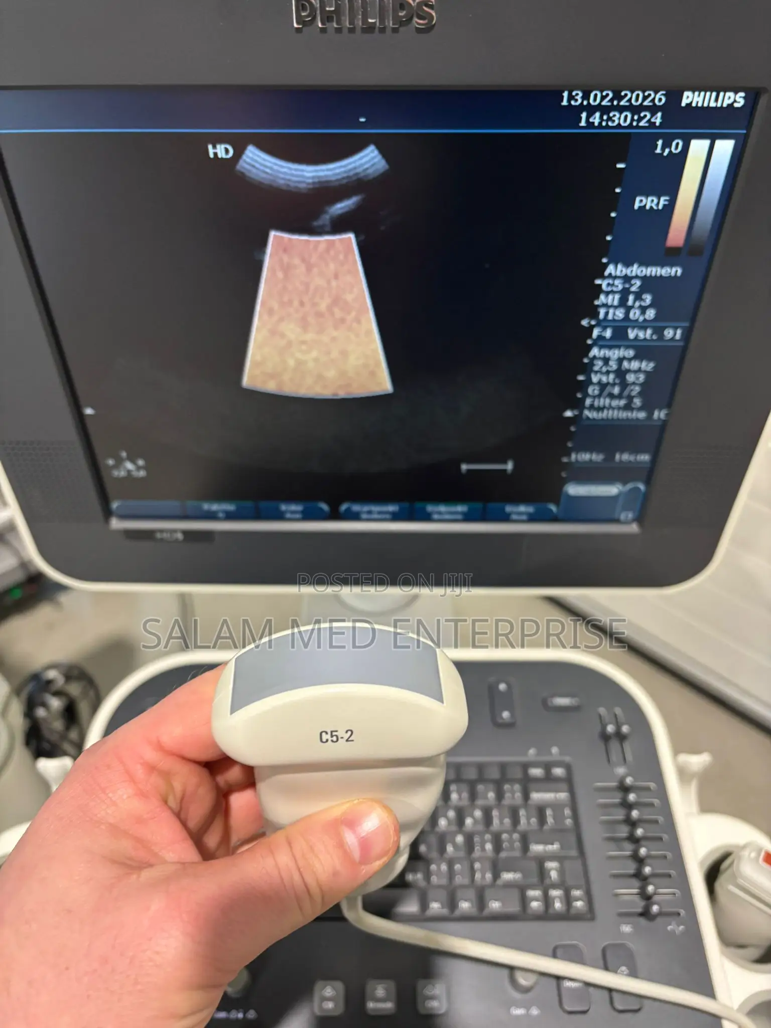 Philips Hd5 Ultrasound Scan Machine