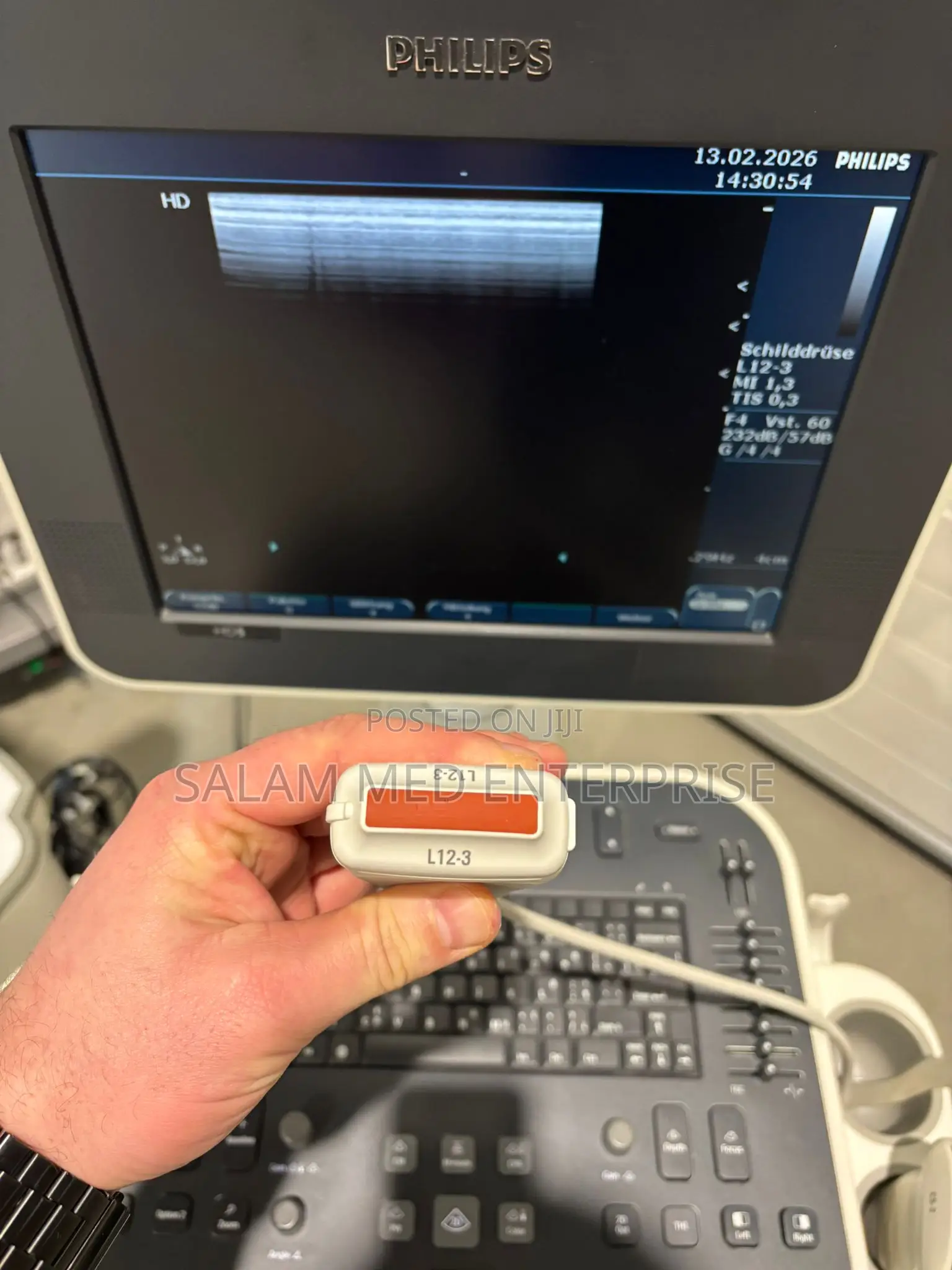 Philips Hd5 Ultrasound Scan Machine