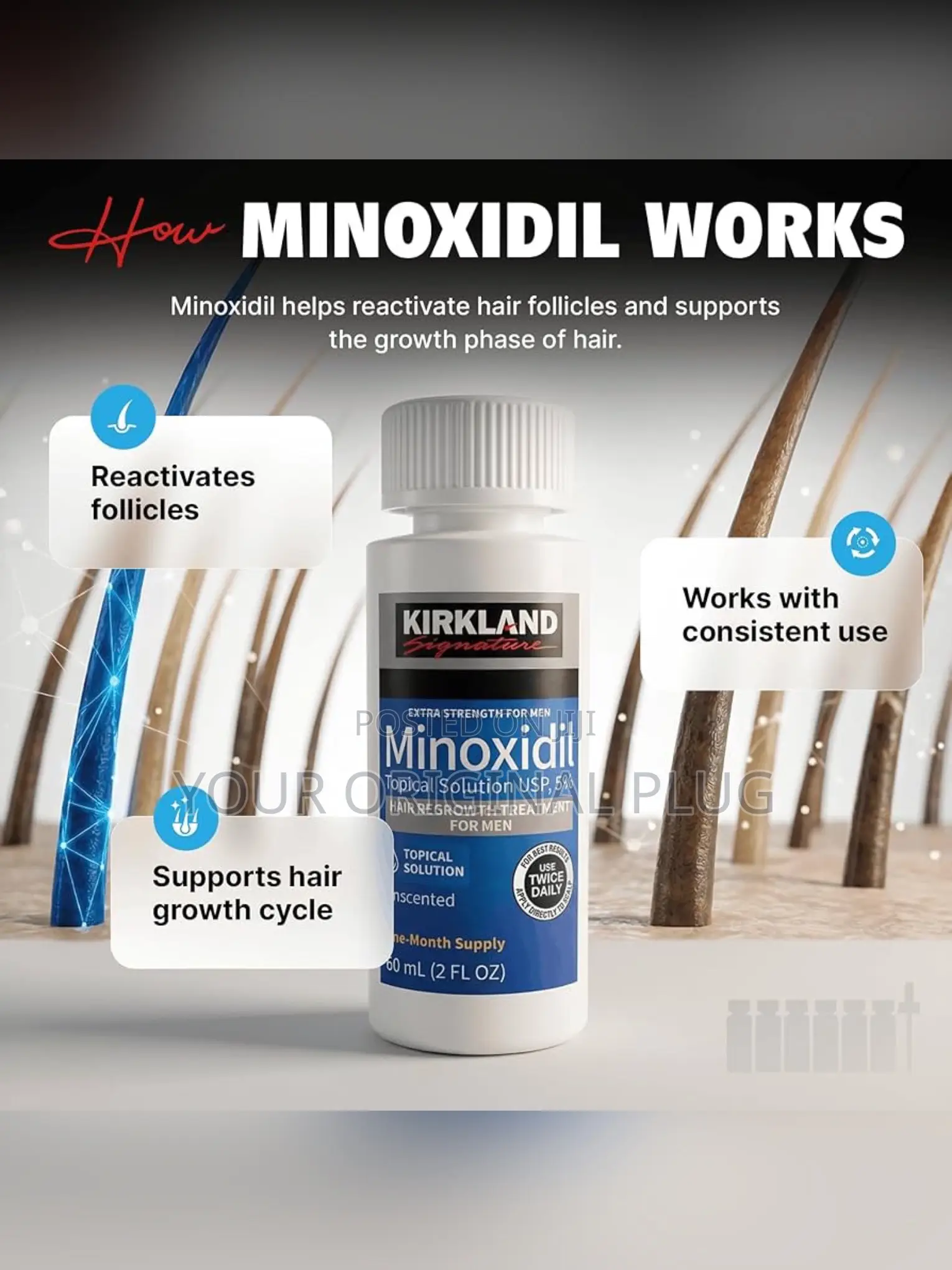 Kirkland Minoxidil 5% Undiluted Effective For Hair Regrowth (Box (1x6)