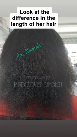 Hair Growth Products