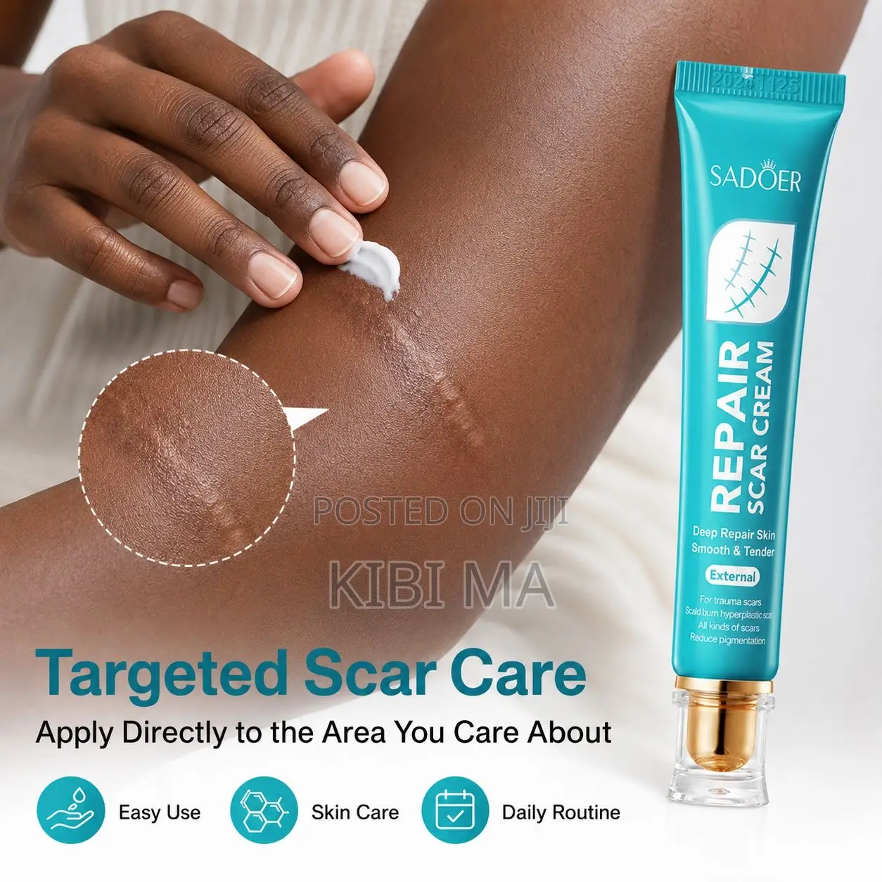 Sadoer Scar Removal Cream