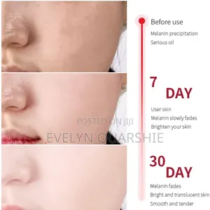 Collagen Facial Serum