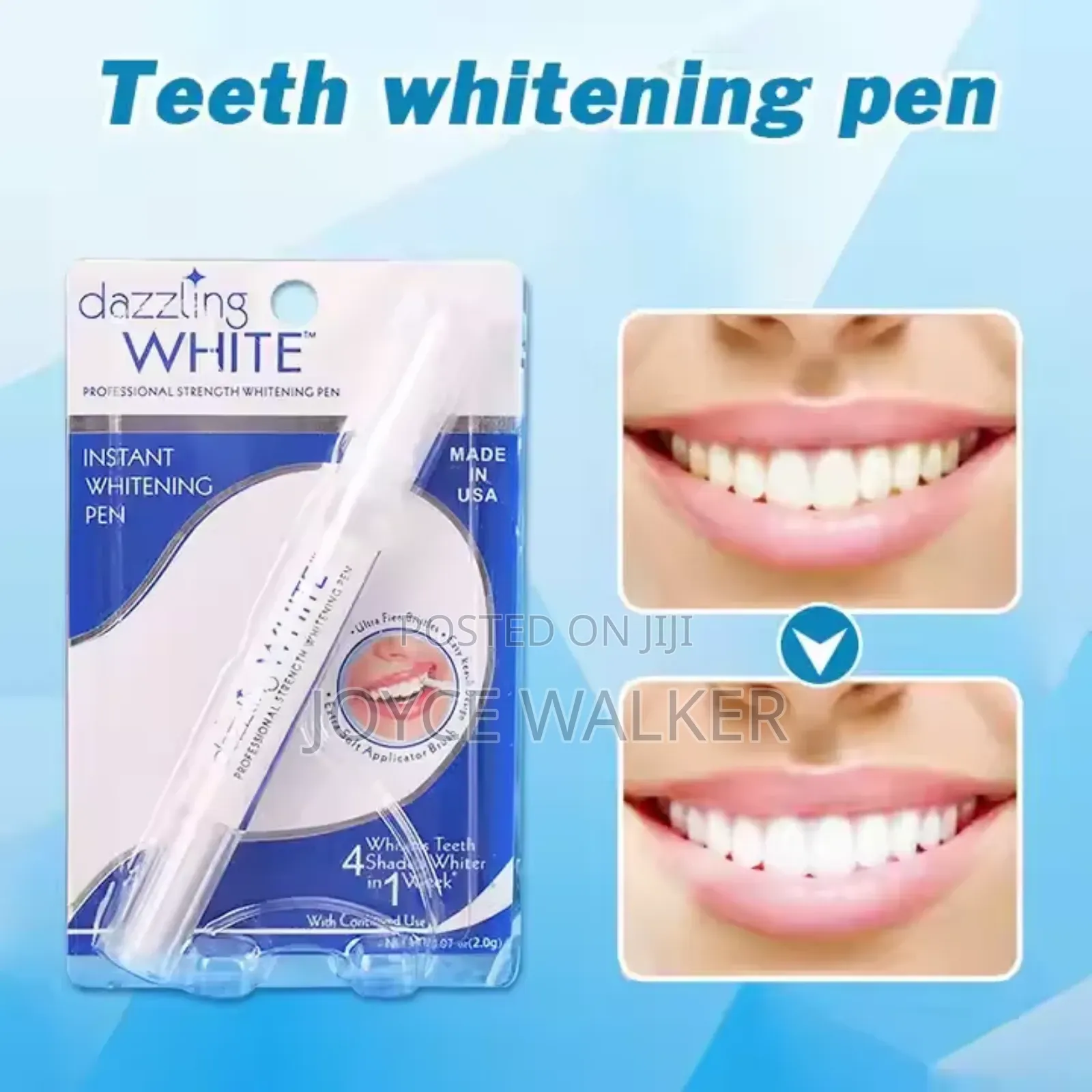 Instant Teeth Whitening Pen