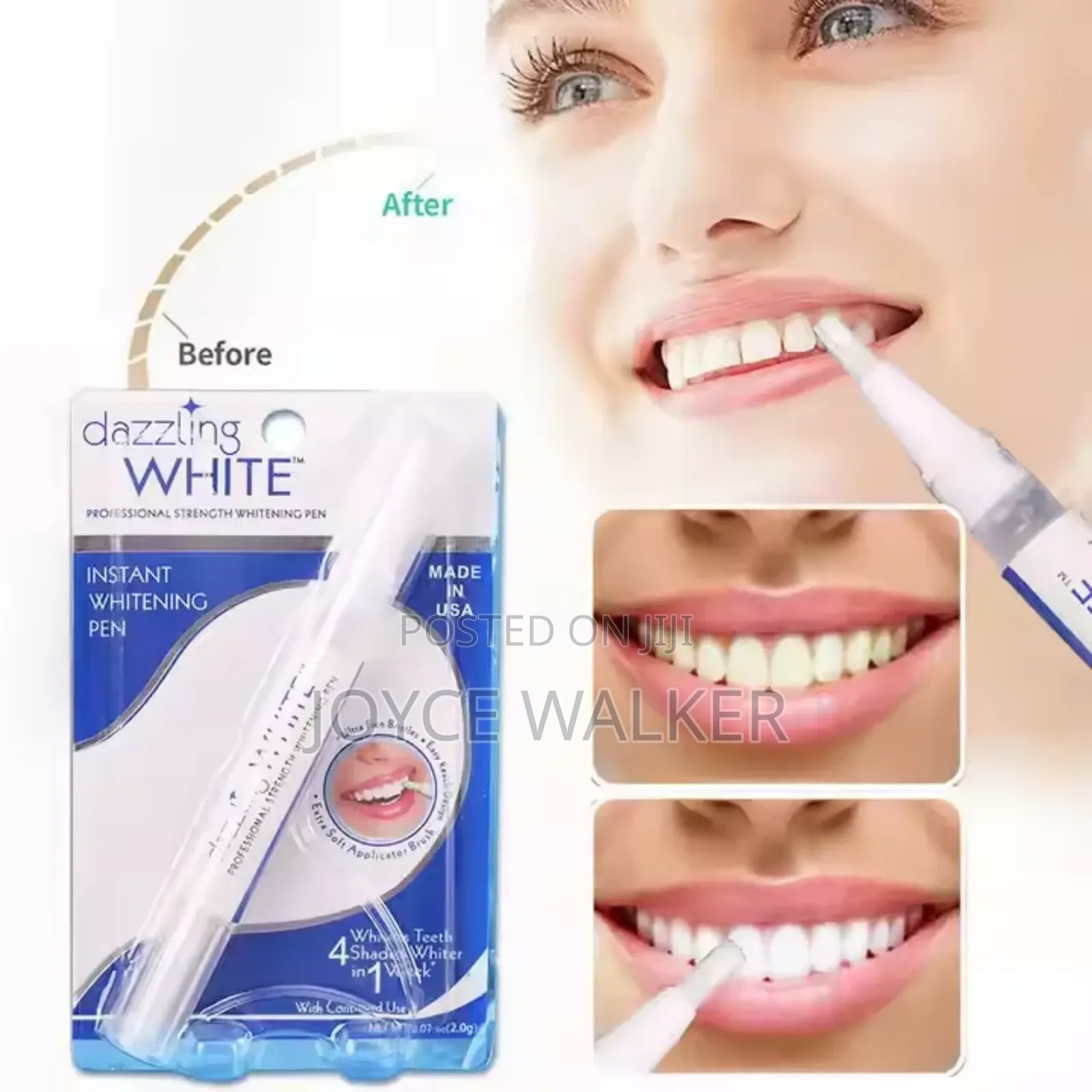 Instant Teeth Whitening Pen
