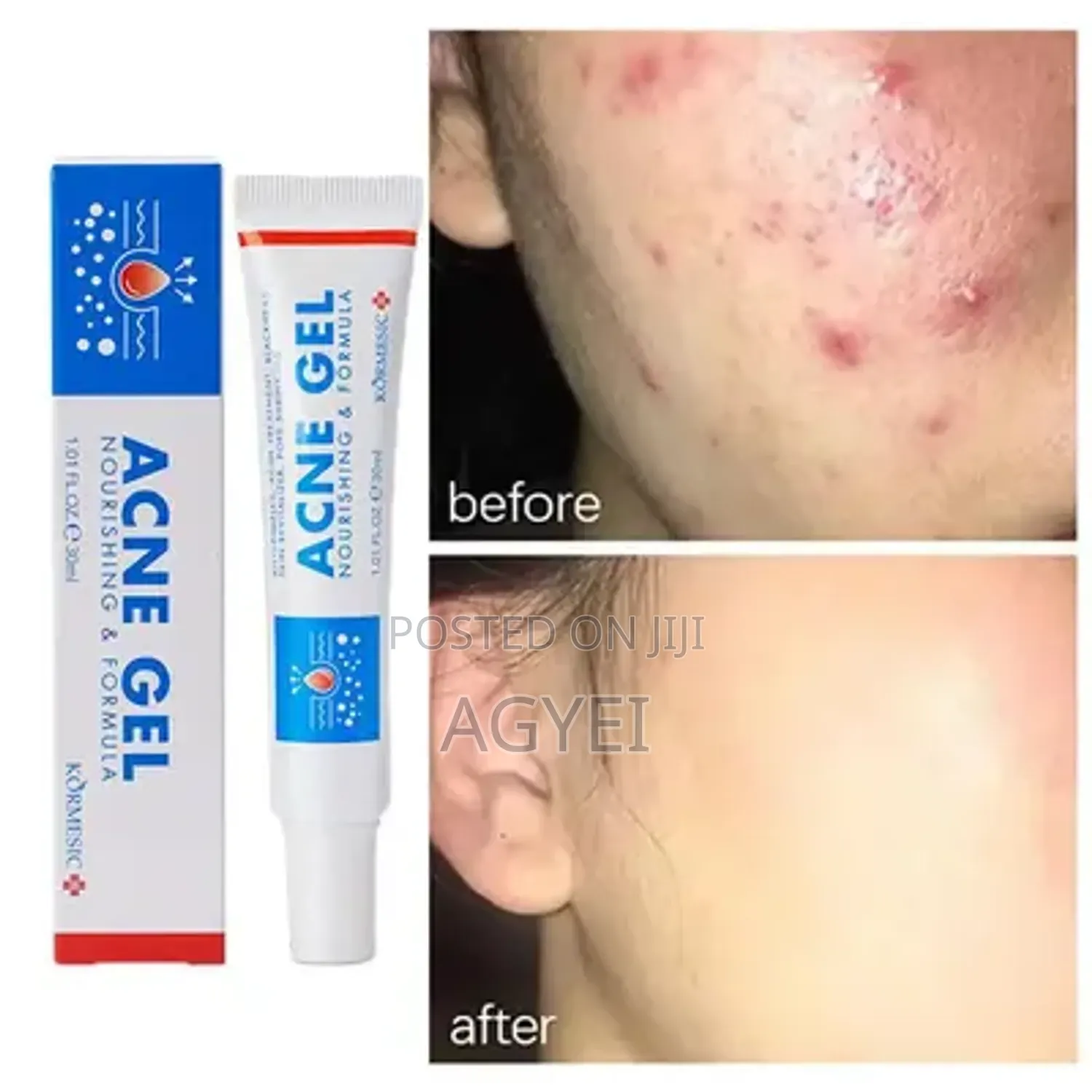 Acne Repair Gel-30ml '755675