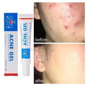 Acne Repair Gel-30ml '755675