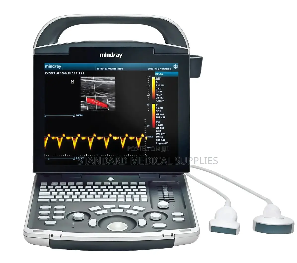 Mindray Dp10 Ultrasound System With Convex Probe