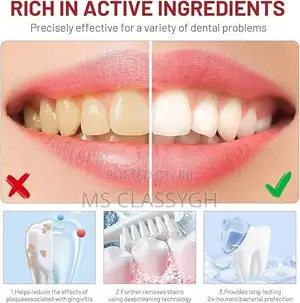 Sp-10 Probiotics Bright Deep Cleaning Stain Removing Toothpaste 120g