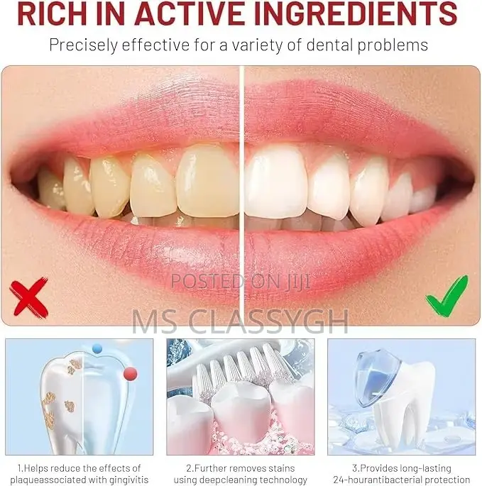 Sp-10 Probiotics Bright Deep Cleaning Stain Removing Toothpaste 120g