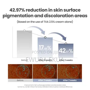 Axis-Y Txa 2.5% Intensive Brightening Cream