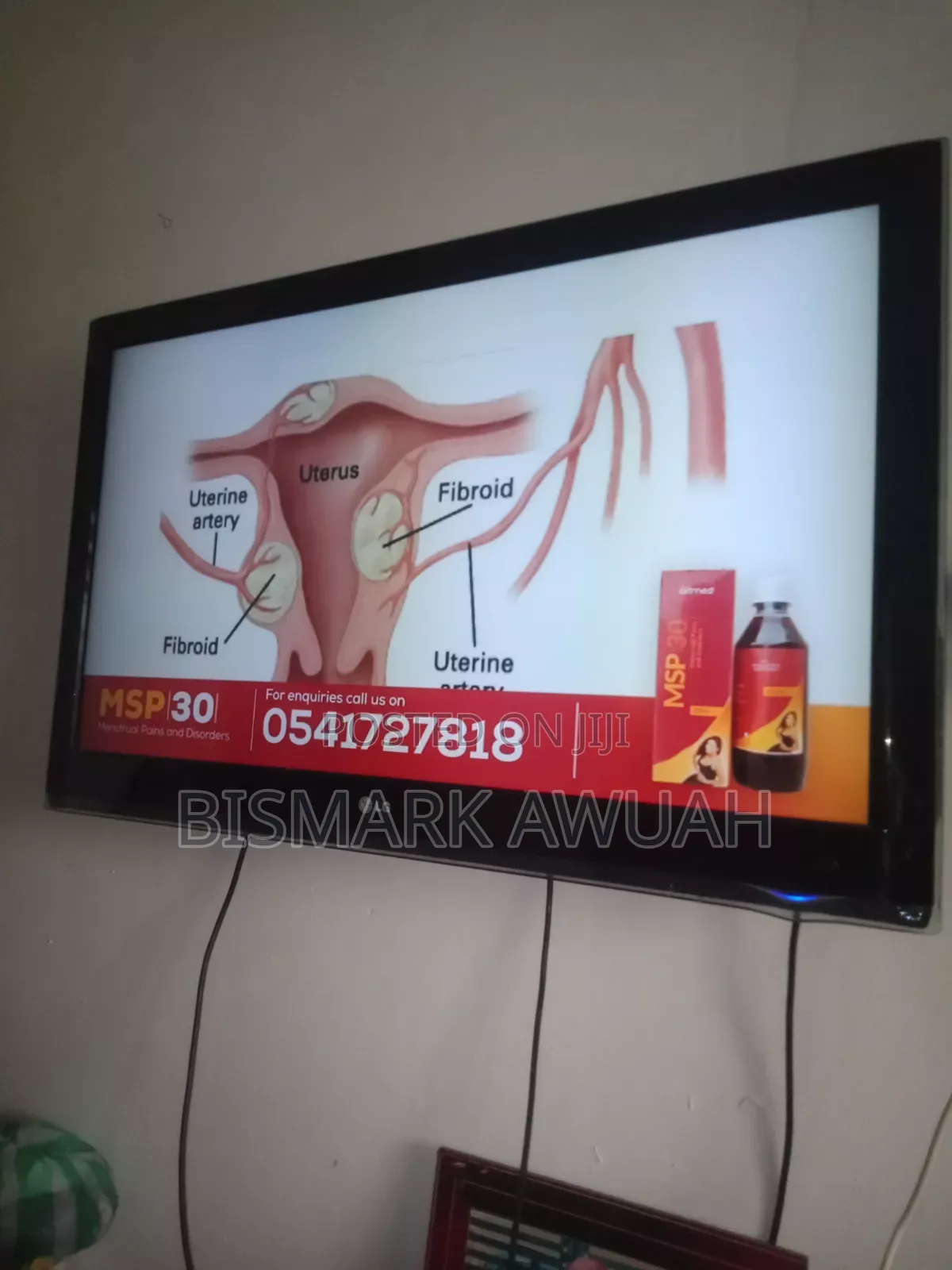 Lg Tv 43 Inches