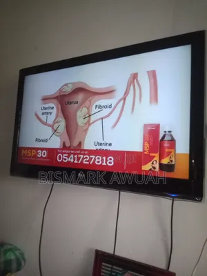 Lg Tv 43 Inches
