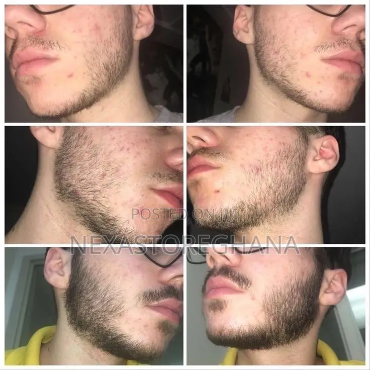 Genuine Kirkland Minoxidil