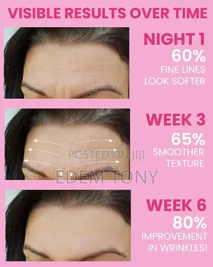 Akissos Facial Wrinkle Patches 80pcs Update Version