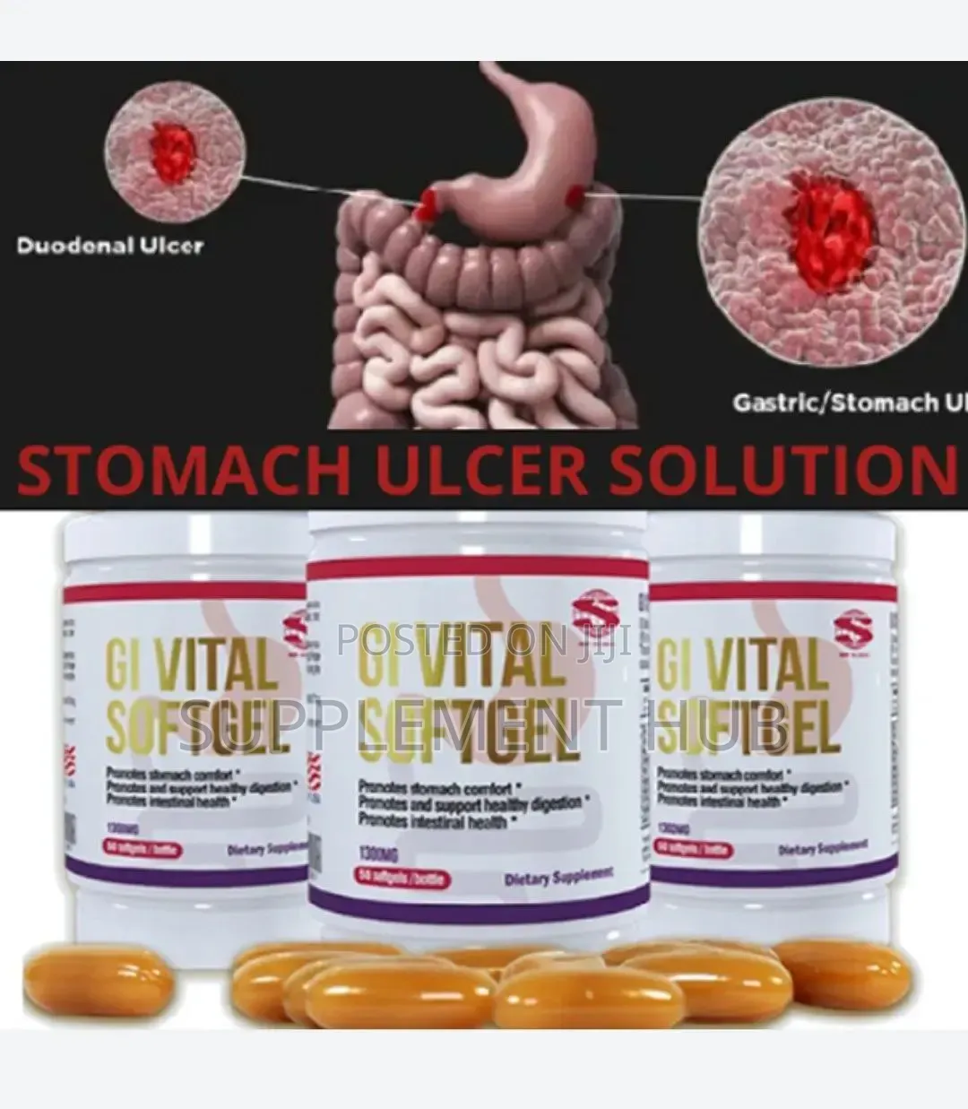 Permanent Ulcer Solution