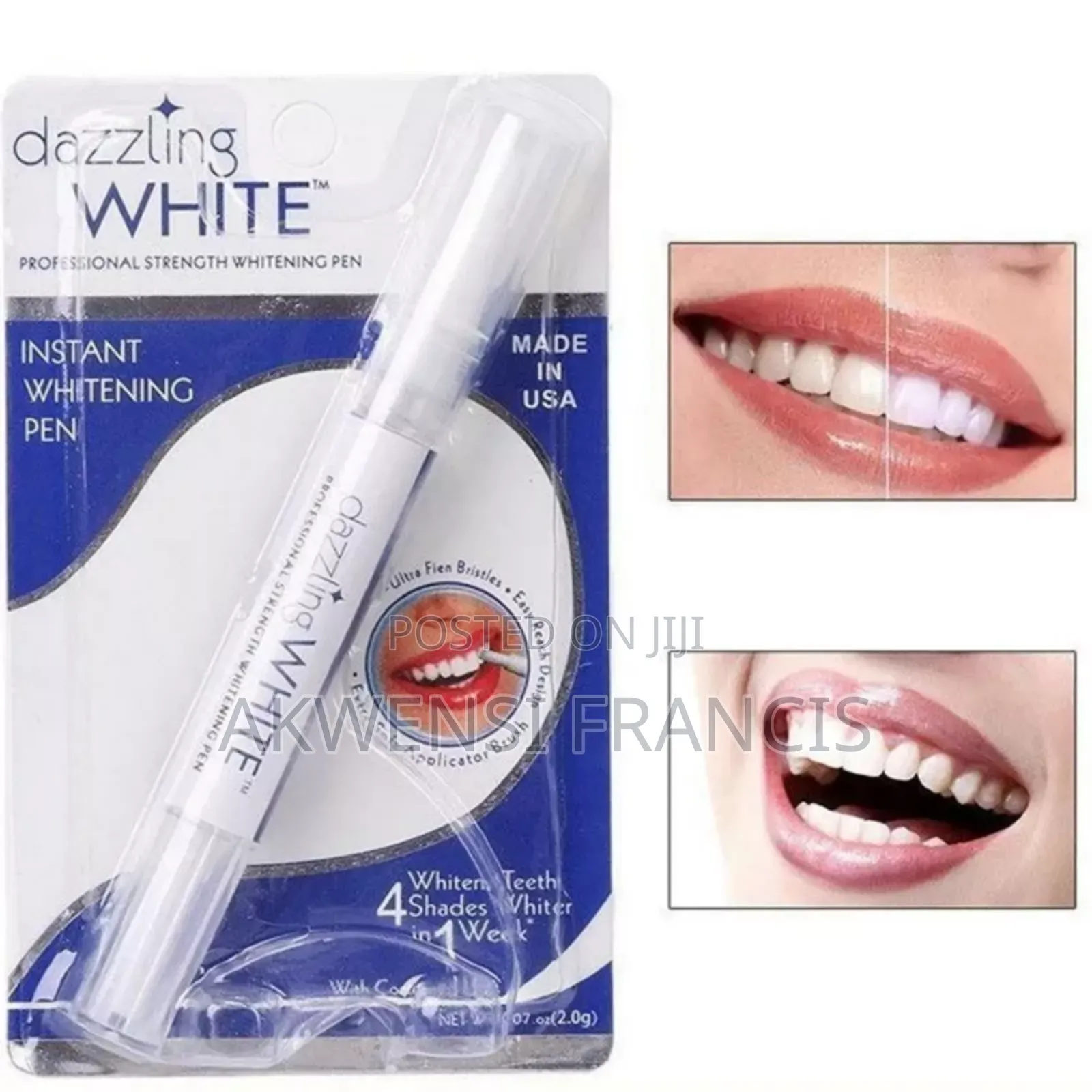Teeth Whitening Pen