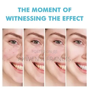 Mooyam Salicylic Acid