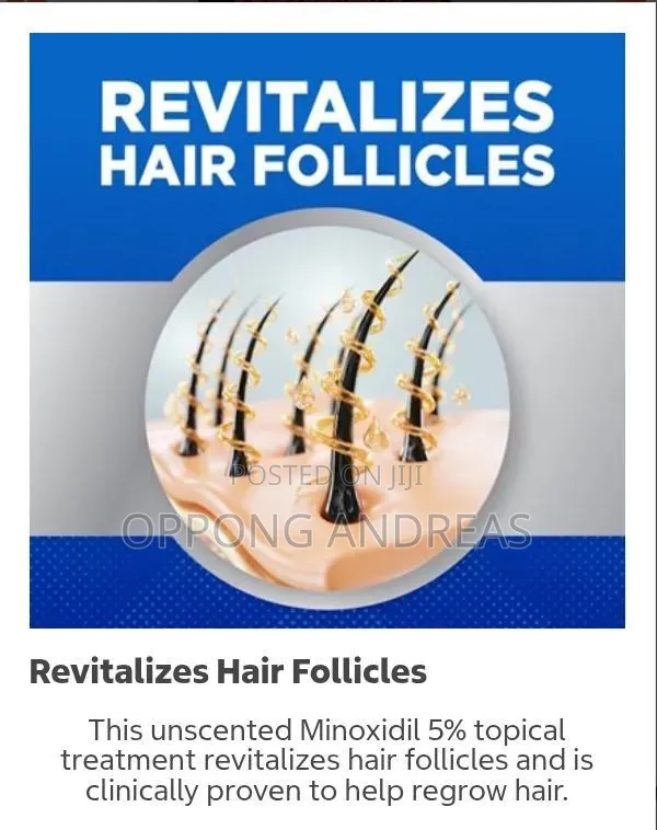 Kirkland Minoxidil 5% Extra Strength Hair Regrowth Solution for Men