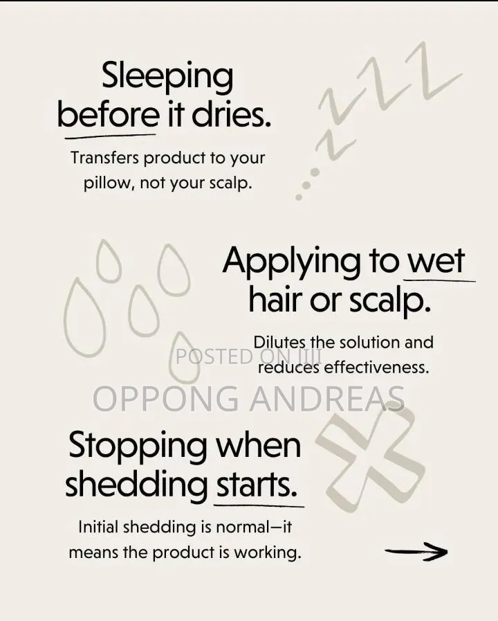 Kirkland Minoxidil 5% Extra Strength Hair Regrowth Solution for Men