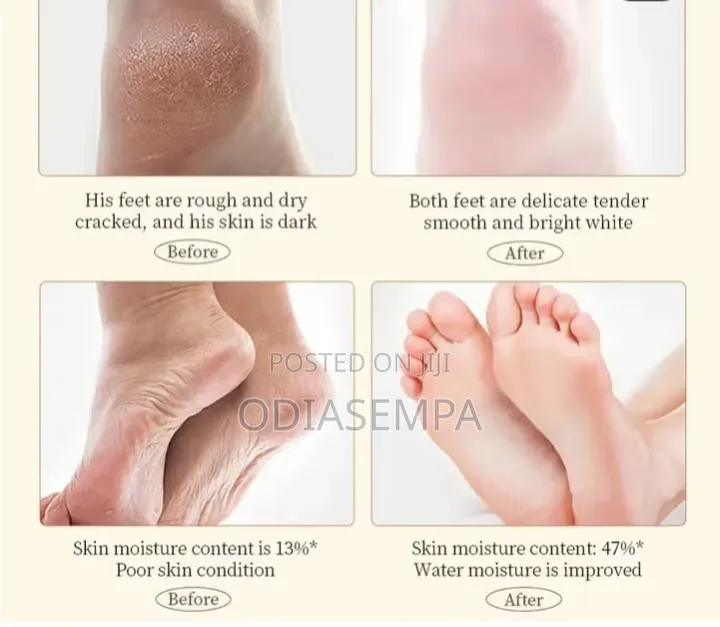 Foot Hand Cream