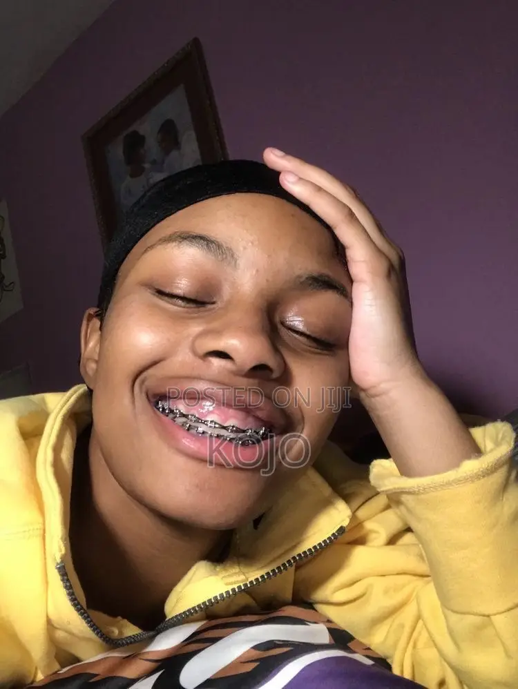 Teeth Braces