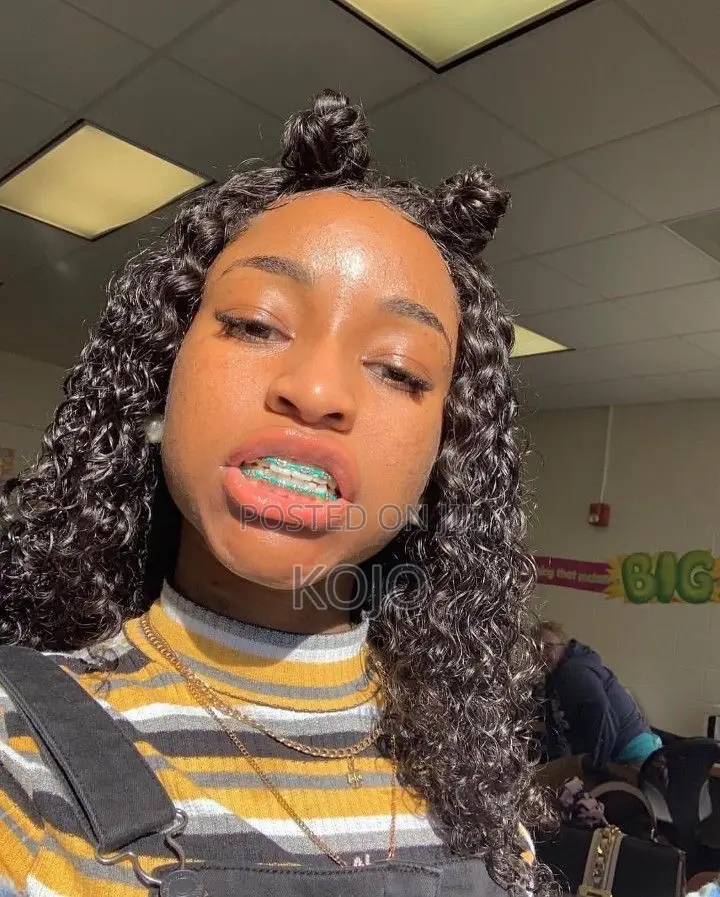 Teeth Braces