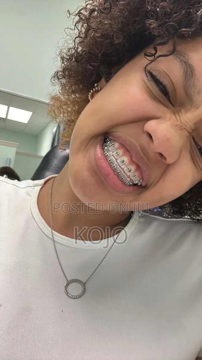 Teeth Braces