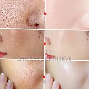 Best Hyaluronic Acid Gel for Face and Neck