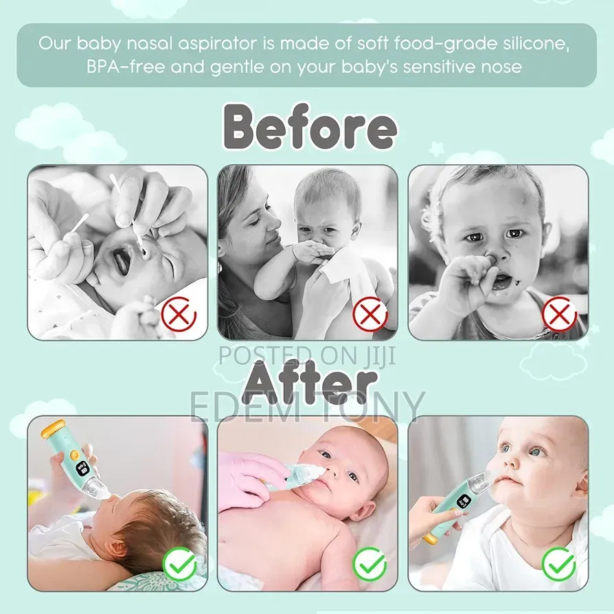 Postuvix Electric Baby Nasal Aspirator