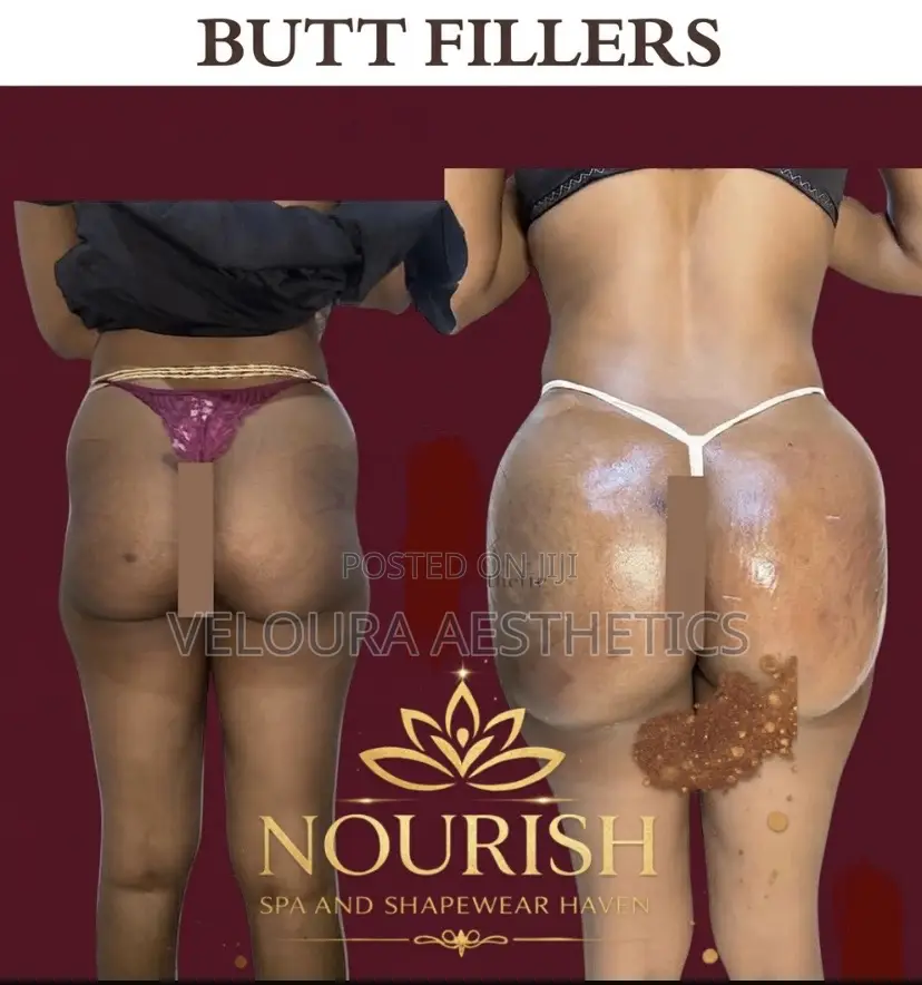 Non-Surgical BBL Fillers | Hip Dip Enhancement | Accra