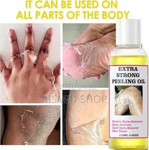 Generic Extra Strong Yellow Peeling Oil