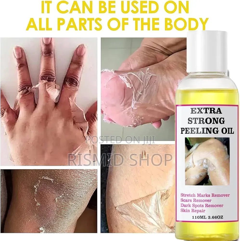 Generic Extra Strong Yellow Peeling Oil