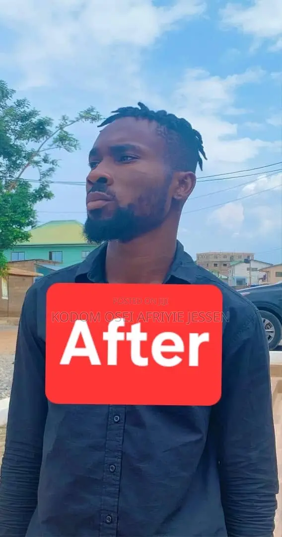 Raki’S Hair Growth