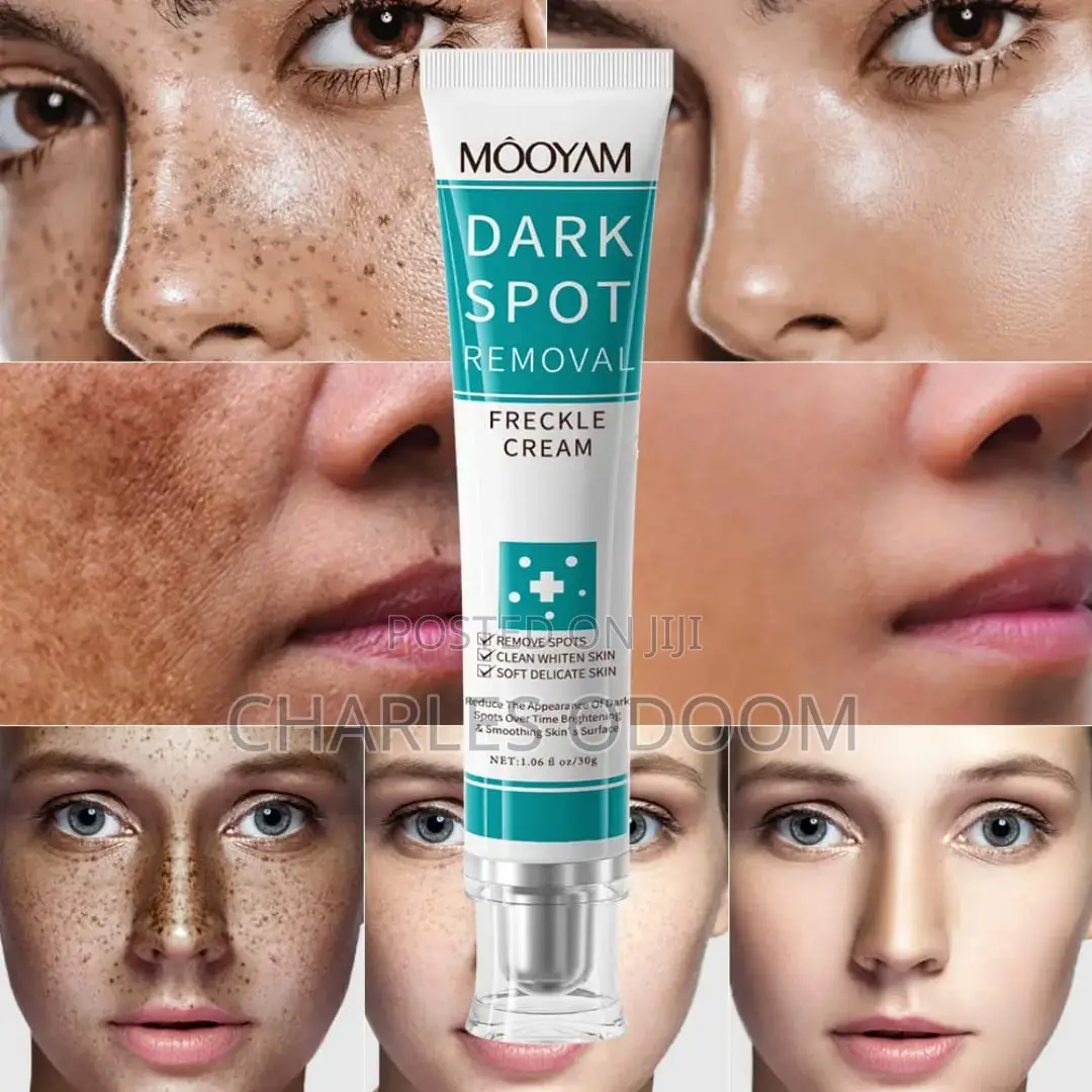 Mooyam Dark Spot Removal Freckle Cream