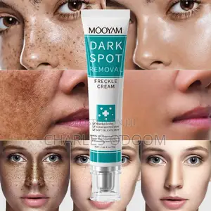 Mooyam Dark Spot Removal Freckle Cream