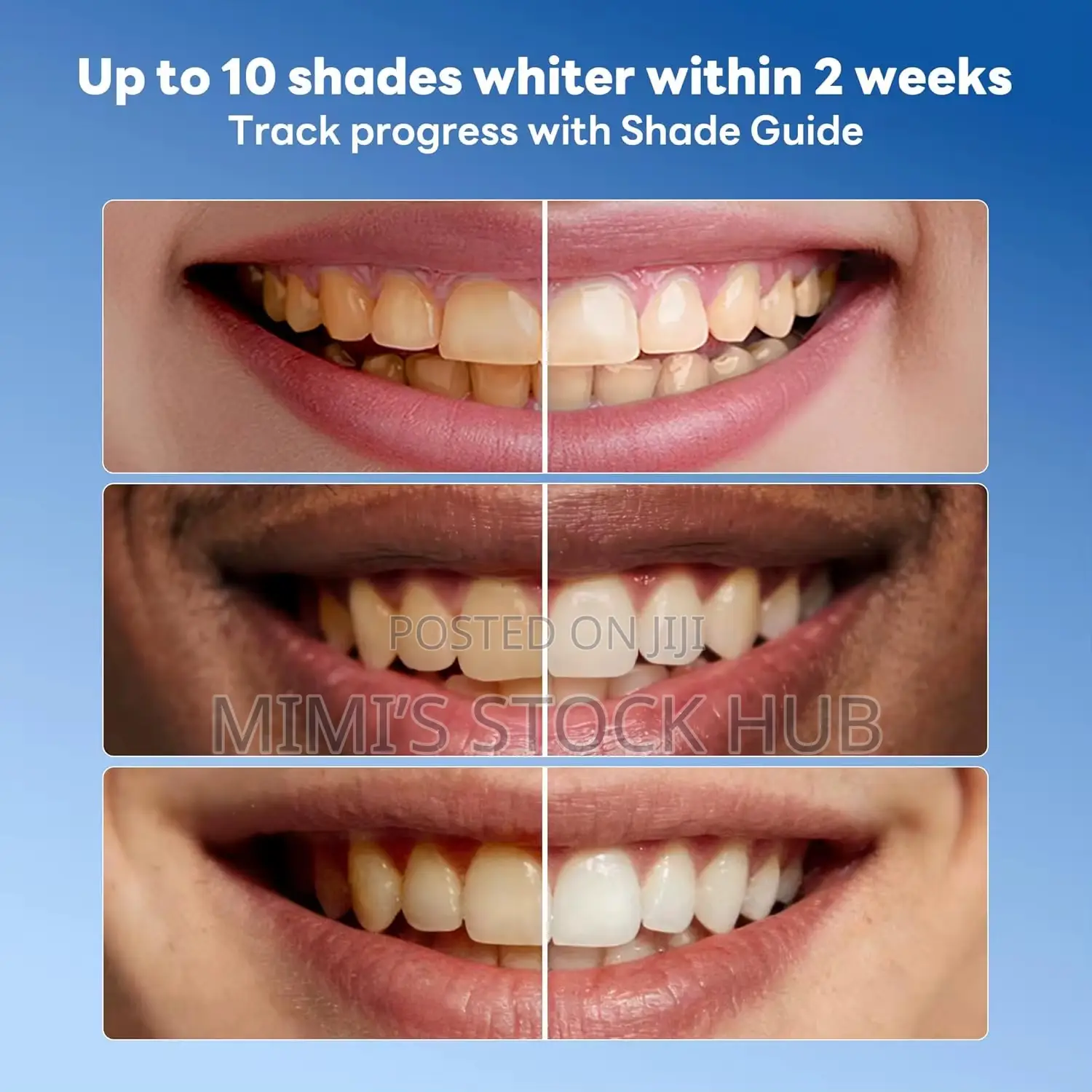 Instant Teeth Whitening Pen