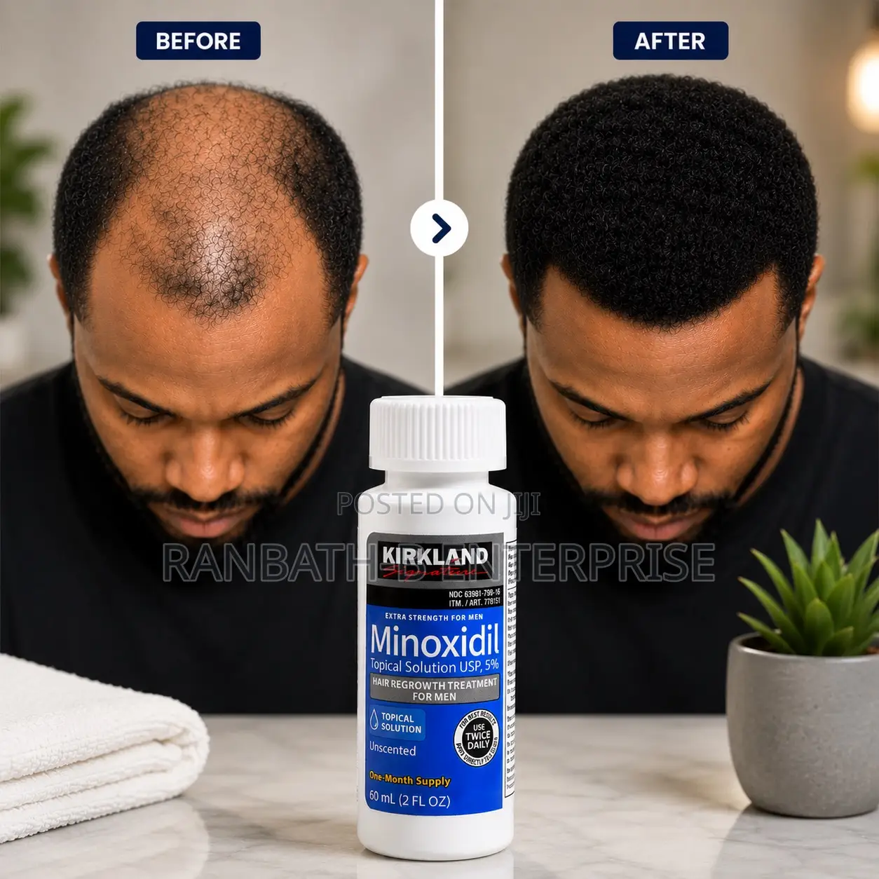 Shop Original Kirkland Minoxidil