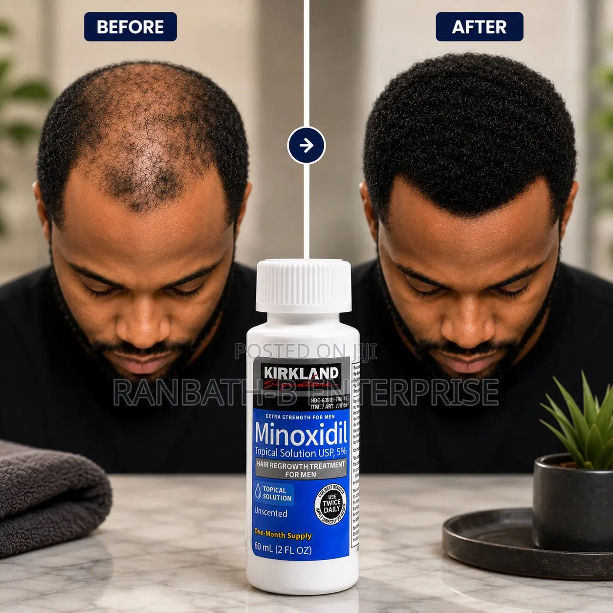 Buy Original Kirkland Minoxidil in Ghana