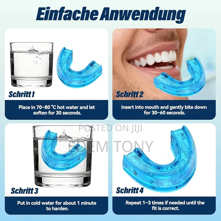 Adjustable Anti-Snoring Mouth Guard – Sleep Aid for Snore