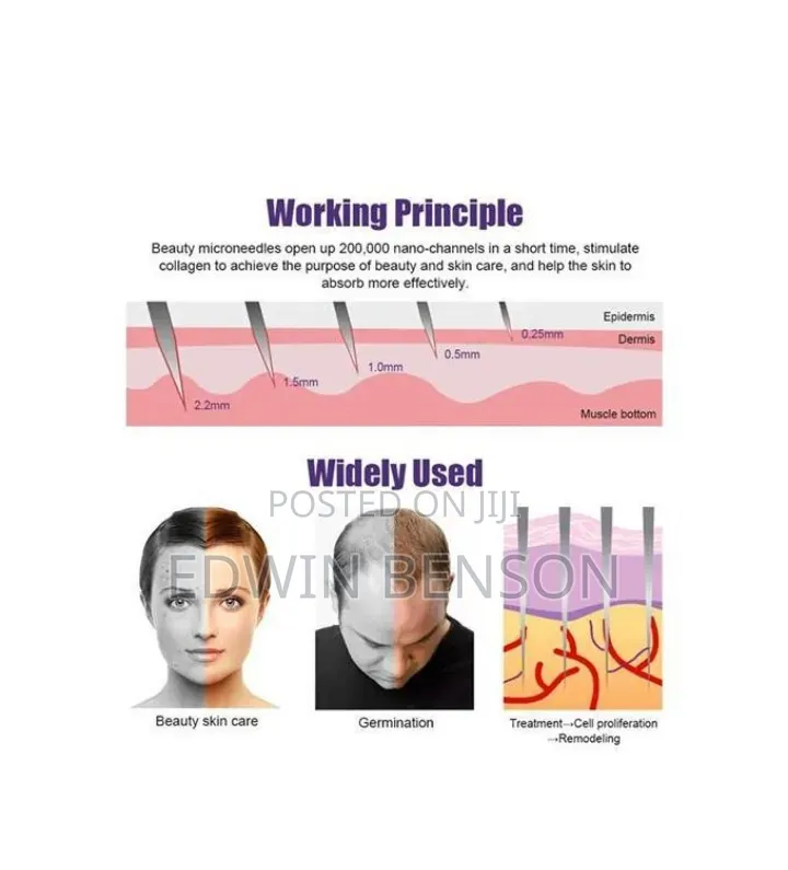 Derma Roller