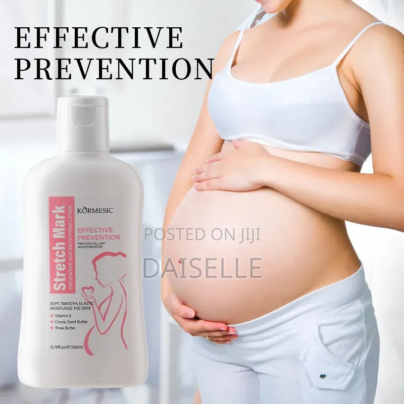 Kormesic Stretch Mark Remover
