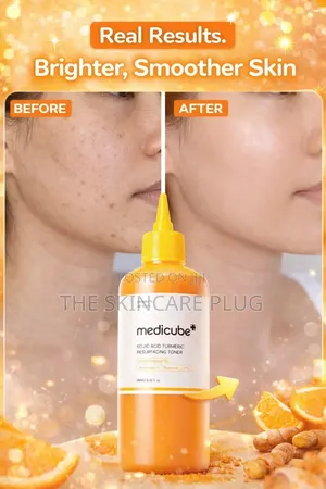 Original Medicube Kojic Acid Tumeric Resurfacing Toner