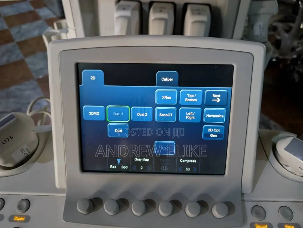 Philips Ultrasound Machine